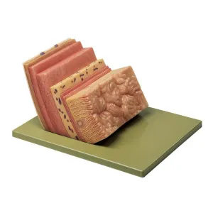 SOMSO Stomach Wall